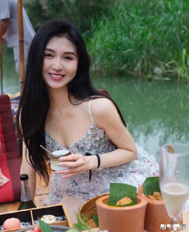 Hot girl Trung Quốc qua đời vì nhiễm trùng sau khi hút mỡ bụng - Ảnh 3. Hot girl Trung Quốc qua đời vì nhiễm trùng sau khi hút mỡ bụng - Ảnh 3.