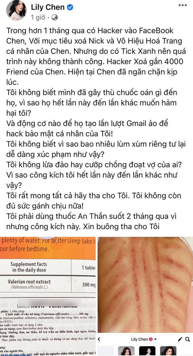 Sau ồn ào chung bồ với Ngọc Trinh, Lily Chen bất ngờ đăng tải hình ảnh tấm lưng rướm máu, tiết lộ dùng thuốc an thần suốt 2 tháng qua - Ảnh 2.