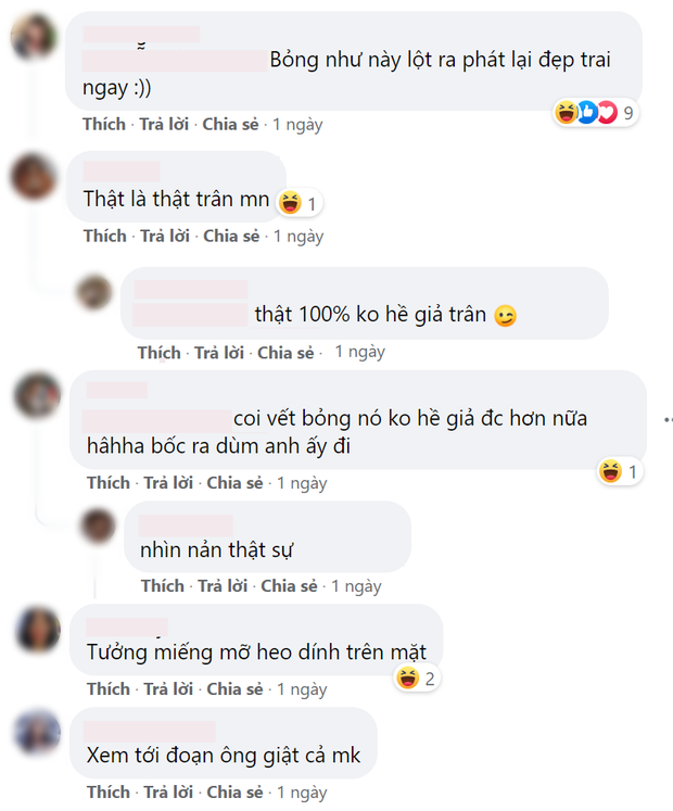 Netizen bóc phốt vết bỏng giả trân của Logan Lee ở Penthouse 3, dính bom mà thế bảo sao không hồi sinh vội - Ảnh 4.