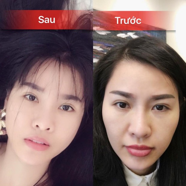 Tìm ra drama queen Vbiz dao kéo nhiều bộ phận nhất cùng 1 lúc, riêng mũi đập tới 6 lần cho... hợp phong thuỷ - Ảnh 2. Tìm ra drama queen Vbiz dao kéo nhiều bộ phận nhất cùng 1 lúc, riêng mũi đập tới 6 lần cho... hợp phong thuỷ - Ảnh 2.