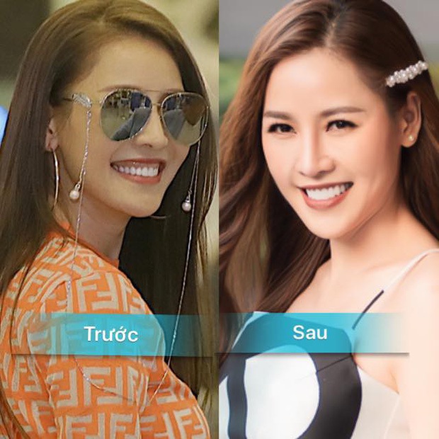 Tìm ra drama queen Vbiz dao kéo nhiều bộ phận nhất cùng 1 lúc, riêng mũi đập tới 6 lần cho... hợp phong thuỷ - Ảnh 6. Tìm ra drama queen Vbiz dao kéo nhiều bộ phận nhất cùng 1 lúc, riêng mũi đập tới 6 lần cho... hợp phong thuỷ - Ảnh 6.