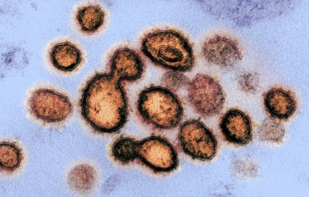 Phát hiện các virus cổ đại bị đóng băng 14.400 năm chưa từng được biết đến - Ảnh 1. Phát hiện các virus cổ đại bị đóng băng 14.400 năm chưa từng được biết đến - Ảnh 1.