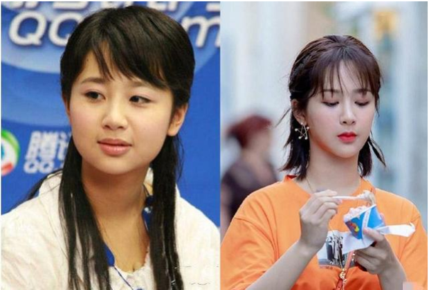 Ảnh ngày còn phèn của mỹ nhân Cbiz: Không chỉ chuyện xấu đẹp, đầy bằng chứng dao kéo đây này! - Ảnh 19. Ảnh ngày còn phèn của mỹ nhân Cbiz: Không chỉ chuyện xấu đẹp, đầy bằng chứng dao kéo đây này! - Ảnh 19.