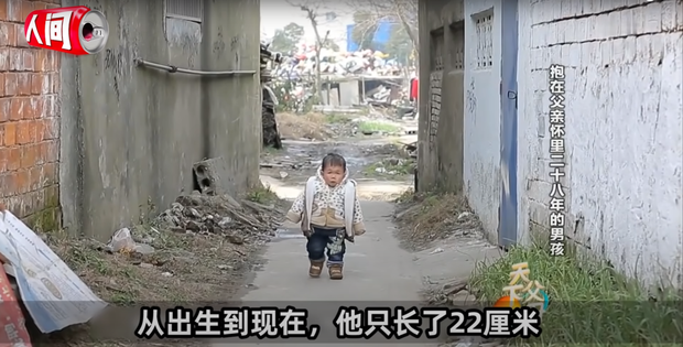 Cậu bé mắc bệnh lạ chỉ cao 68cm do ngừng phát triển từ năm 1 tuổi gây xúc động với cuộc sống và diện mạo hiện tại sau hơn 30 năm  - Ảnh 6.