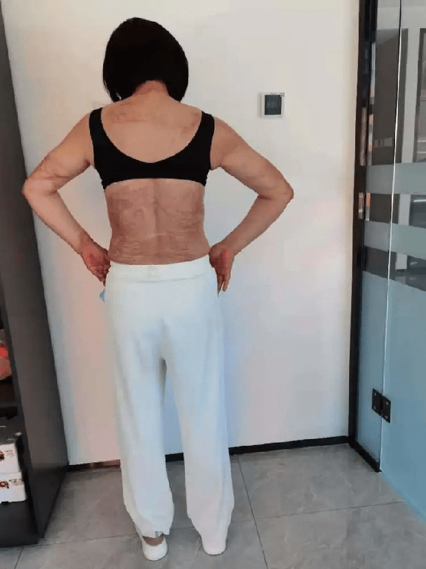 Bị bạn trai cũ cuồng ghen tạt axit và đeo bám suốt 12 năm trời, người phụ nữ suýt bị đâm kim tiêm chứa HIV vào người đã có màn lật kèo đỉnh cao - Ảnh 4.