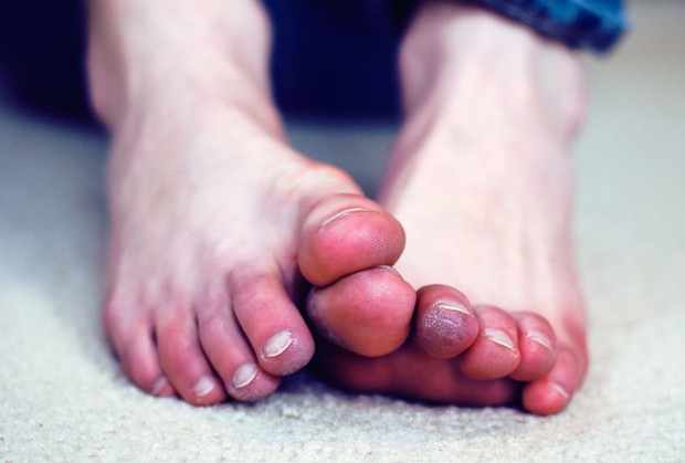 5 triệu chứng ở chân cho thấy cơ thể bạn đang trên đà lão hóa, mắc phải dù chỉ 1 cái cũng đã rất đáng lo - Ảnh 3.