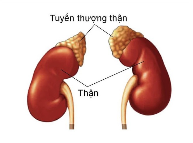 Tự mua thuốc giảm đau về uống, người phụ nữ mắc biến chứng nặng - Ảnh 1.