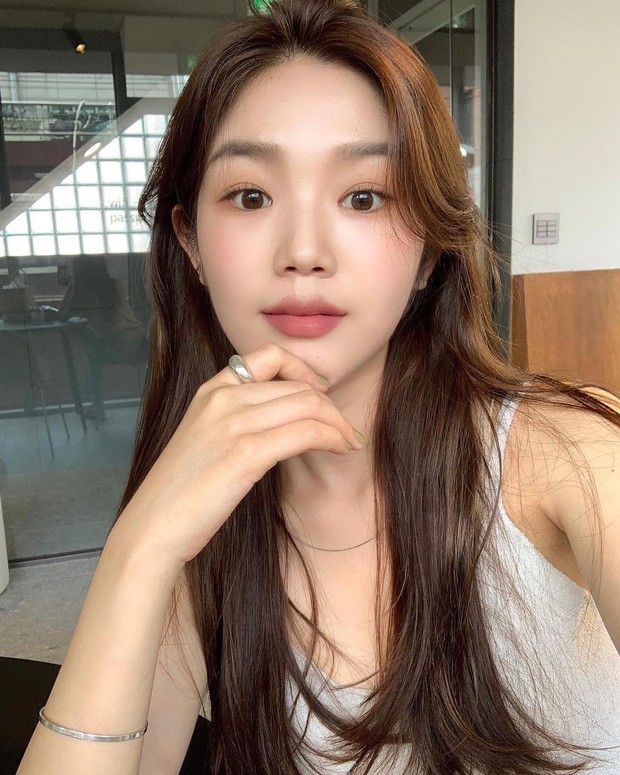Tiêm Mũi hay Làm Mũi? Từ chia sẻ của bác sĩ thẩm mỹ, bạn sẽ biết nên chọn phương pháp nào để sớm có giao diện chuẩn xinh - Ảnh 4.
