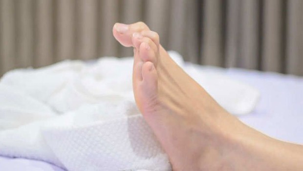 4 hiện tượng bất thường xuất hiện ở chân là dấu hiệu cảnh báo mỡ máu cao mà bạn không nên chủ quan bỏ qua - Ảnh 2.