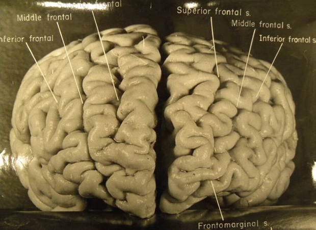 Chuyến phiêu lưu của bộ não Albert Einstein, người có IQ cao nhất thế giới sau khi nó bị đánh cắp khỏi cơ thể - Ảnh 1. Chuyến phiêu lưu của bộ não Albert Einstein, người có IQ cao nhất thế giới sau khi nó bị đánh cắp khỏi cơ thể - Ảnh 1.