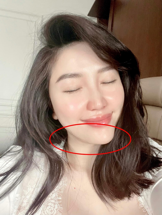 Bảo Thy nói gì khi bị soi cằm lệch, rộ nghi vấn gọt hàm trùng tu nhan sắc? - Ảnh 1. Bảo Thy nói gì khi bị soi cằm lệch, rộ nghi vấn gọt hàm trùng tu nhan sắc? - Ảnh 1.