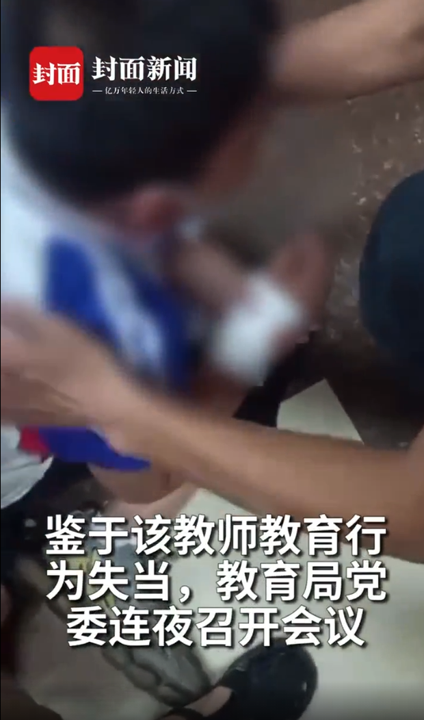 Học sinh tiểu học viết chữ xấu bị cô giáo rạch tay gây chấn động dư luận Trung Quốc - Ảnh 2.