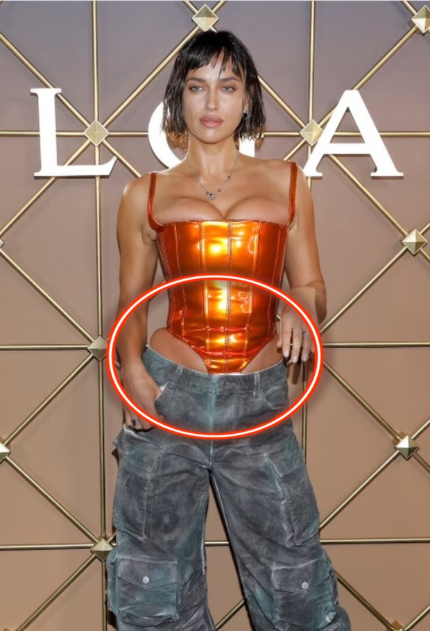 Kinh hoàng người mẫu nổi tiếng bức tử body trong corset siêu chật, nhìn hình PTS mà ám ảnh! - Ảnh 3. Kinh hoàng người mẫu nổi tiếng bức tử body trong corset siêu chật, nhìn hình PTS mà ám ảnh! - Ảnh 3.