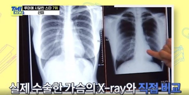 Bị netizen nghi ngờ đại tu vòng 1 ngồn ngộn, nữ hoàng gợi cảm Lee Hyori có màn đáp trả không thể nào đanh thép hơn - Ảnh 6. Bị netizen nghi ngờ đại tu vòng 1 ngồn ngộn, nữ hoàng gợi cảm Lee Hyori có màn đáp trả không thể nào đanh thép hơn - Ảnh 6.