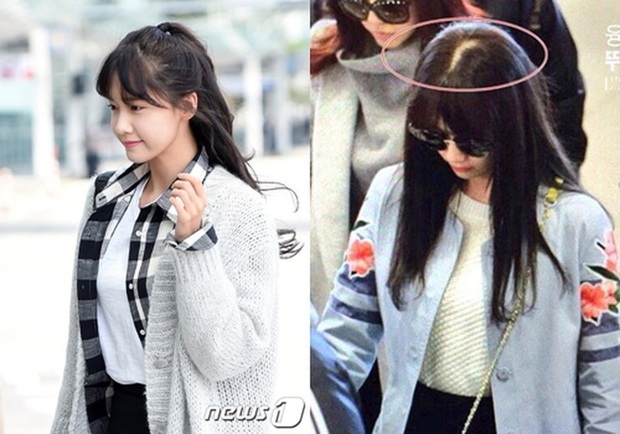 Đến hẹn lại lên, Yoona lại lộ nhược điểm chí mạng rồi! - Ảnh 3. Đến hẹn lại lên, Yoona lại lộ nhược điểm chí mạng rồi! - Ảnh 3.