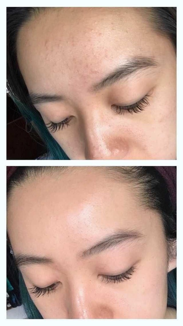 Lưu huỳnh có nhiều công dụng dưỡng da hơn bạn tưởng, nàng da mụn đặc biệt nên biết! - Ảnh 3. Lưu huỳnh có nhiều công dụng dưỡng da hơn bạn tưởng, nàng da mụn đặc biệt nên biết! - Ảnh 3.