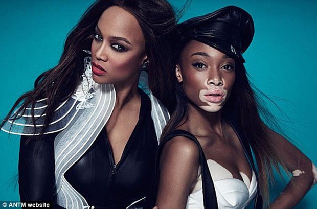 Siêu mẫu bạch biến Winnie Harlow thả rông trên thảm đỏ Met Gala 2021 - Ảnh 5. Siêu mẫu bạch biến Winnie Harlow thả rông trên thảm đỏ Met Gala 2021 - Ảnh 5.