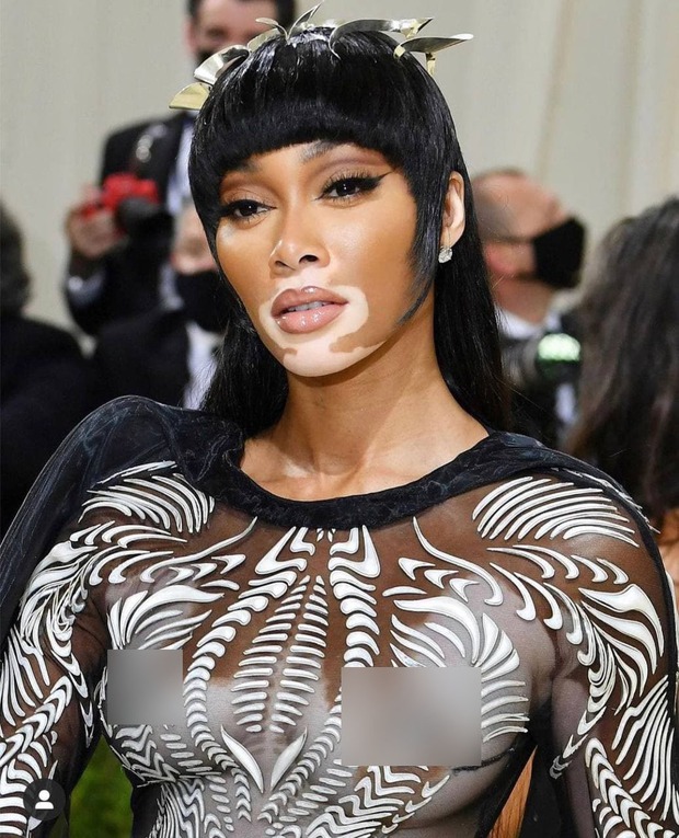 Siêu mẫu bạch biến Winnie Harlow thả rông trên thảm đỏ Met Gala 2021 - Ảnh 1. Siêu mẫu bạch biến Winnie Harlow thả rông trên thảm đỏ Met Gala 2021 - Ảnh 1.