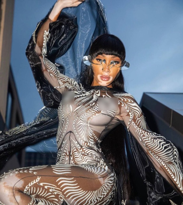 Siêu mẫu bạch biến Winnie Harlow thả rông trên thảm đỏ Met Gala 2021 - Ảnh 2. Siêu mẫu bạch biến Winnie Harlow thả rông trên thảm đỏ Met Gala 2021 - Ảnh 2.