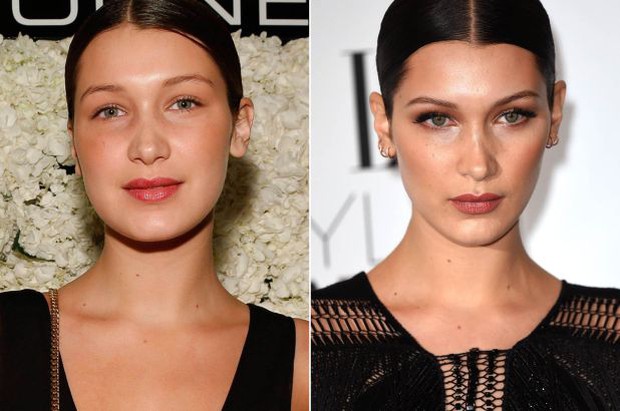 Bella Hadid có gương mặt tỷ lệ hoàn hảo hiếm hoi đến mức bác sĩ thẩm mỹ phải công nhận nhưng hóa ra từng làm 2 thủ thuật này? - Ảnh 5.