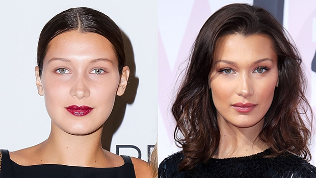 Bella Hadid có gương mặt tỷ lệ hoàn hảo hiếm hoi đến mức bác sĩ thẩm mỹ phải công nhận nhưng hóa ra từng làm 2 thủ thuật này? - Ảnh 6.