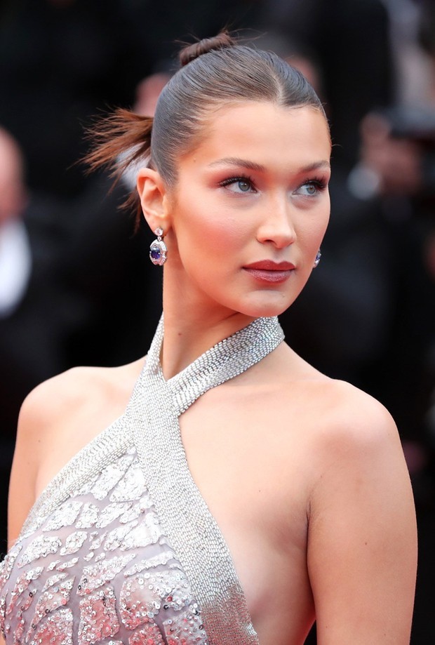 Bella Hadid có gương mặt tỷ lệ hoàn hảo hiếm hoi đến mức bác sĩ thẩm mỹ phải công nhận nhưng hóa ra từng làm 2 thủ thuật này? - Ảnh 11.