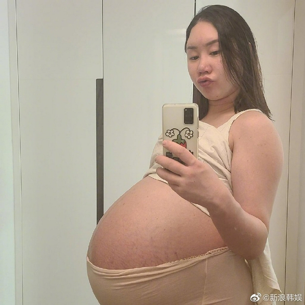 Mỹ nhân Hàn khoe vòng 2 muốn nổ tung vì mang thai sinh ba, tăng tới 44kg và phải ngồi xe lăn di chuyển - Ảnh 3. Mỹ nhân Hàn khoe vòng 2 muốn nổ tung vì mang thai sinh ba, tăng tới 44kg và phải ngồi xe lăn di chuyển - Ảnh 3.