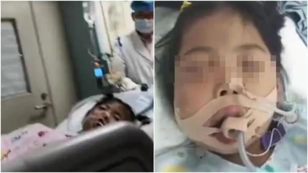 Quiz: Có 6 nhóm người không nên nhổ răng vì rủi ro cao, thử xem bạn có thuộc nhóm nào không - Ảnh 1. Quiz: Có 6 nhóm người không nên nhổ răng vì rủi ro cao, thử xem bạn có thuộc nhóm nào không - Ảnh 1.