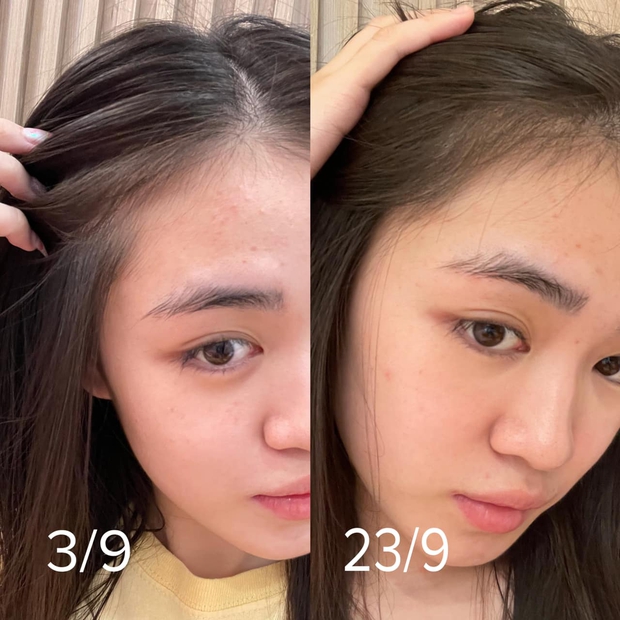 3 tuần để cứu lại mái tóc gãy rụng và tổn thương, cô bạn này đã làm những gì? - Ảnh 11. 3 tuần để cứu lại mái tóc gãy rụng và tổn thương, cô bạn này đã làm những gì? - Ảnh 11.