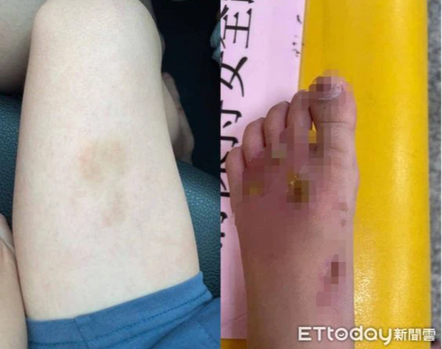 Gửi con trai cho bảo mẫu một tháng, mẹ bàng hoàng phát hiện vết thương khủng khiếp trên người con, ân hận vì đã tin lầm quỷ dữ - Ảnh 1. Gửi con trai cho bảo mẫu một tháng, mẹ bàng hoàng phát hiện vết thương khủng khiếp trên người con, ân hận vì đã tin lầm quỷ dữ - Ảnh 1.
