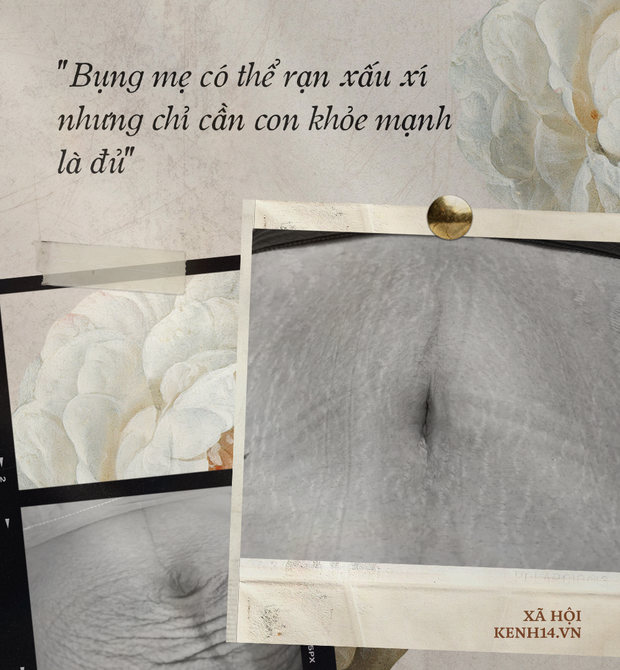 Các mẹ bầu đồng loạt khoe bụng đầy vết rạn thâm đen dưới bài đăng của Hòa Minzy: Những dấu tích của sự hi sinh, của tình yêu thương vô bờ bến - Ảnh 4. Các mẹ bầu đồng loạt khoe bụng đầy vết rạn thâm đen dưới bài đăng của Hòa Minzy: Những dấu tích của sự hi sinh, của tình yêu thương vô bờ bến - Ảnh 4.