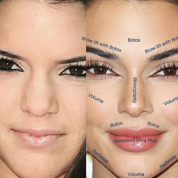 Nếu Kendall Jenner nói cô ấy đẹp tự nhiên, bạn đừng tin! - Ảnh 3.