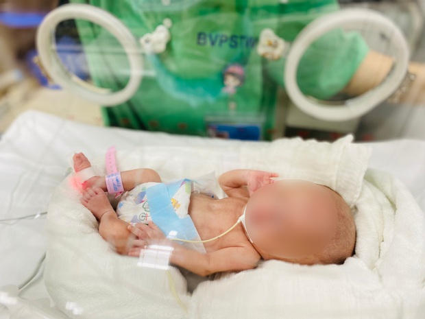 Kỳ tích cứu sống bé gái sinh non nhẹ cân nhất Việt Nam chỉ nặng 400 gram - Ảnh 1. Kỳ tích cứu sống bé gái sinh non nhẹ cân nhất Việt Nam chỉ nặng 400 gram - Ảnh 1.