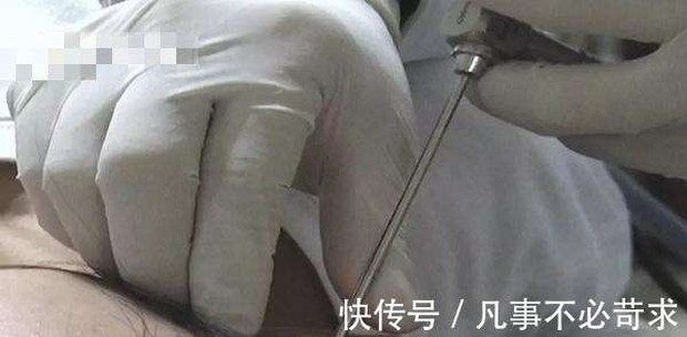 Con trai 8 tuổi khóc thảm thiết, bố mẹ đưa đến bác sĩ thì phát hiện con nhét một thứ vào tai, khi lấy ra ai xem cũng hãi - Ảnh 1. Con trai 8 tuổi khóc thảm thiết, bố mẹ đưa đến bác sĩ thì phát hiện con nhét một thứ vào tai, khi lấy ra ai xem cũng hãi - Ảnh 1.