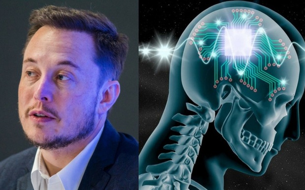 Công ty của Elon Musk chuẩn bị cấy ghép chip vào não người để chế tạo siêu nhân - Ảnh 1.