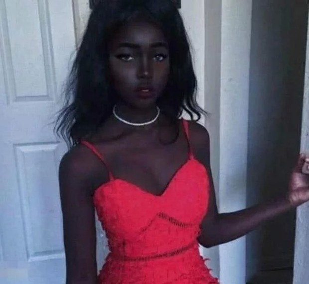 Cô gái da đen đẹp nhất thế giới, đến mức bị cha mẹ cấm ra đường, sau 5 năm cuộc sống hiện tại giờ ra sao? - Ảnh 2.