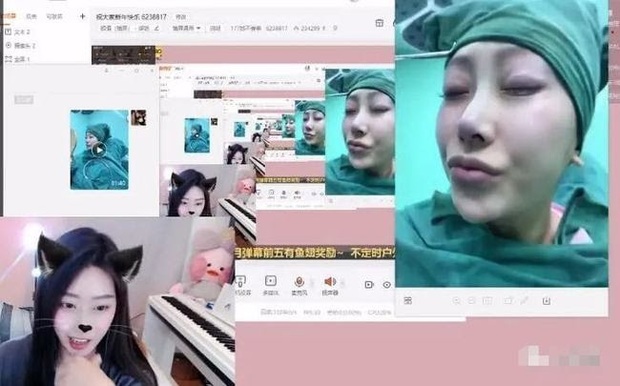 Nữ streamer thừa nhận xinh đẹp nhờ phẫu thuật thẩm mỹ, thậm chí công khai cả video quá trình dao kéo ngay trên sóng trực tiếp - Ảnh 5.