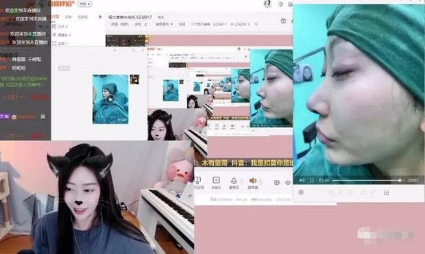 Nữ streamer thừa nhận xinh đẹp nhờ phẫu thuật thẩm mỹ, thậm chí công khai cả video quá trình dao kéo ngay trên sóng trực tiếp - Ảnh 6.