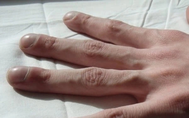Những thay đổi ở móng tay phản ánh bất thường về sức khỏe và khả năng sinh sản - Ảnh 3.