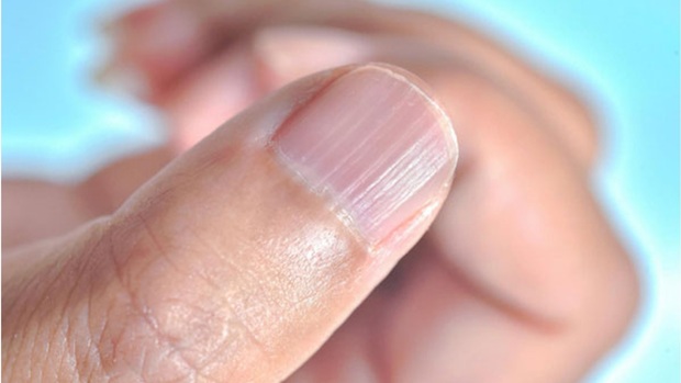 Những thay đổi ở móng tay phản ánh bất thường về sức khỏe và khả năng sinh sản - Ảnh 2.