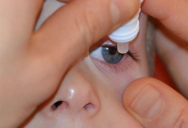 Cậu bé 10 tuổi suýt bị mù vì thói quen dùng thuốc nhỏ mắt mà nhiều bố mẹ vẫn làm - Ảnh 3.