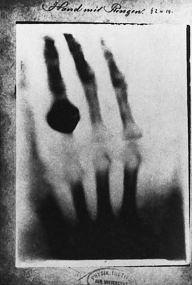 Vén màn sự thật đau đớn đằng sau thí nghiệm tạo ra tia X-quang đầu tiên trên thế giới - Ảnh 1.