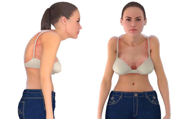 Nhìn người mẫu 3D này, chị em sẽ biết ngay tác hại của việc mặc 1 chiếc áo ngực không phù hợp - Ảnh 1.