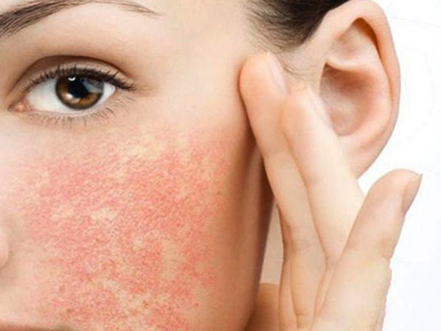 Cà chua tốt cho sức khỏe nhưng có những người không nên ăn - Ảnh 4. Cà chua tốt cho sức khỏe nhưng có những người không nên ăn - Ảnh 4.