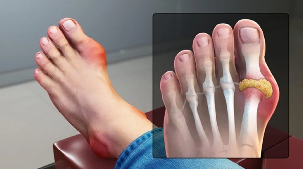 Cà chua tốt cho sức khỏe nhưng có những người không nên ăn - Ảnh 1. Cà chua tốt cho sức khỏe nhưng có những người không nên ăn - Ảnh 1.