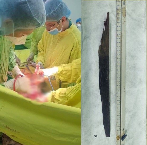 Thiếu niên 17 tuổi gặp tai nạn thương tâm vì tránh con chó lao ra đường - Ảnh 1. Thiếu niên 17 tuổi gặp tai nạn thương tâm vì tránh con chó lao ra đường - Ảnh 1.