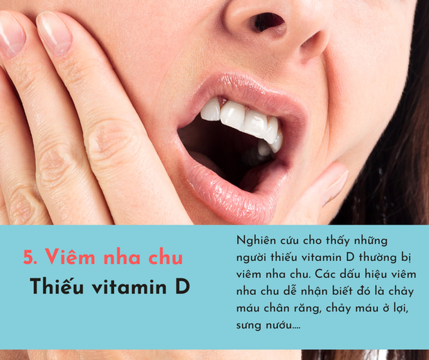 Cơ thể bị cạn kiệt vitamin sẽ phát ra 6 dấu hiệu, chủ quan bỏ qua có thể tổn thọ - Ảnh 5.
