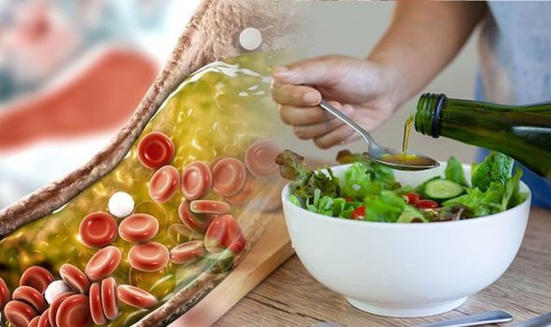 Dấu hiệu đầu tiên cảnh báo tình trạng cholesterol cao có thể làm tắc nghẽn động mạch của bạn - Ảnh 3.