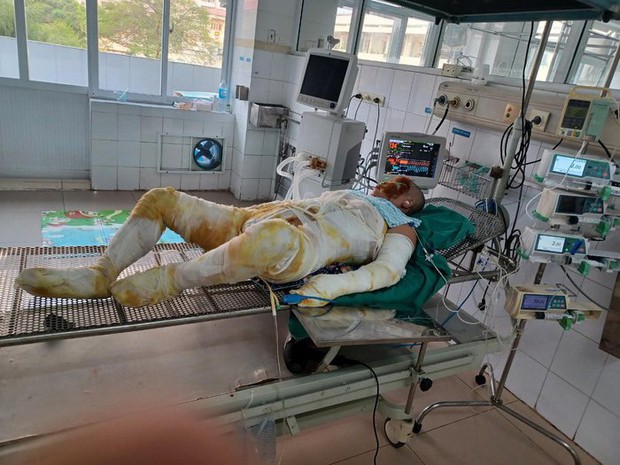 Vụ 3 con đốt nhà mẹ đẻ: Sau khi tỉnh, mẹ tôi đã khóc rất nhiều... - Ảnh 1.