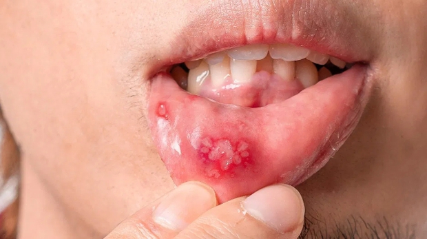 Miệng liên tục gặp phải 4 điều khó chịu này thì có lẽ gan bạn đã bị tổn thương nghiêm trọng - Ảnh 1.